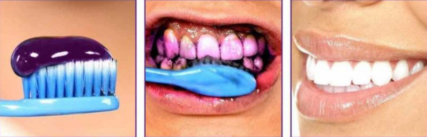 SmileKit Violet 👉 El truco del color para equilibrar tonos amarillos