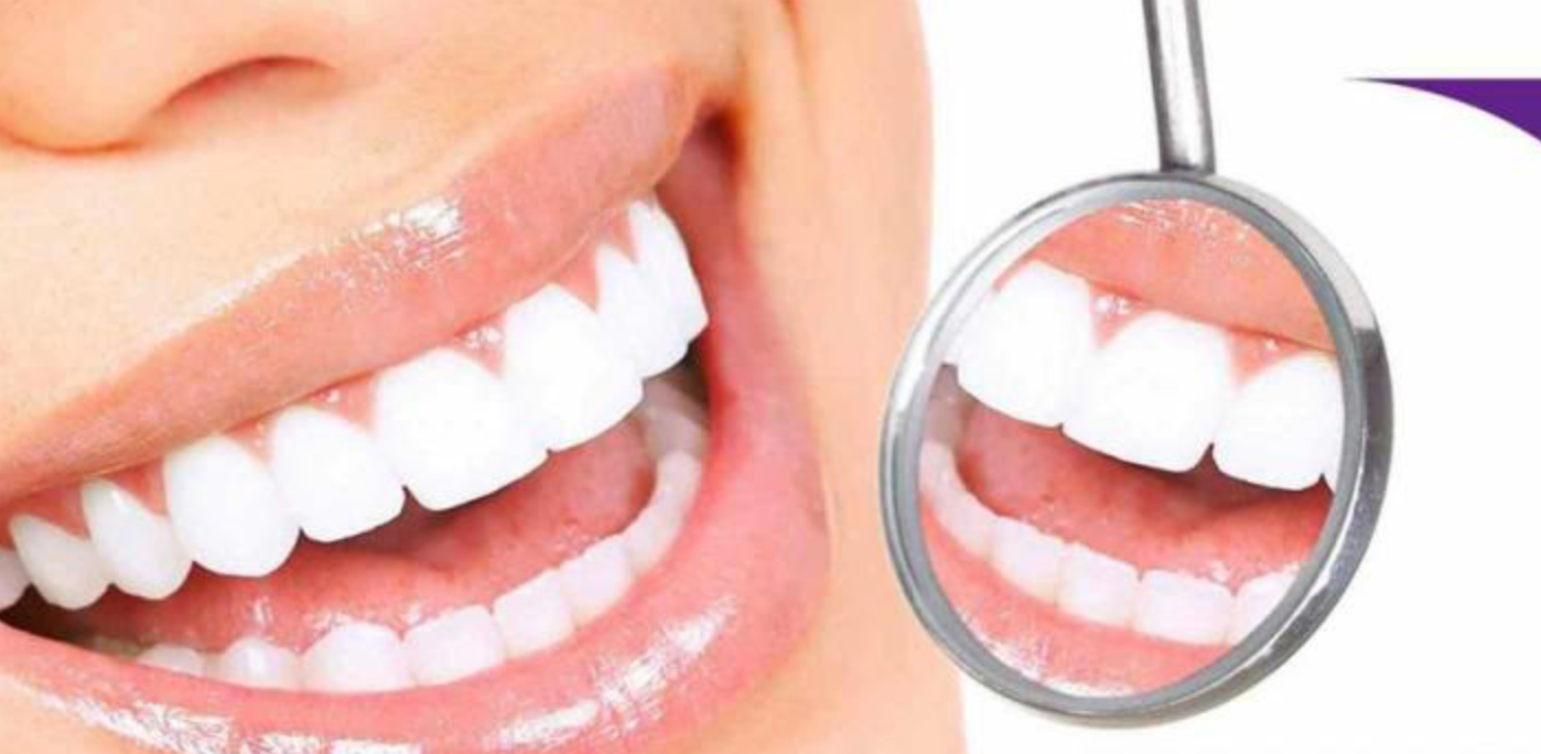 SmileKit Violet 👉 El truco del color para equilibrar tonos amarillos