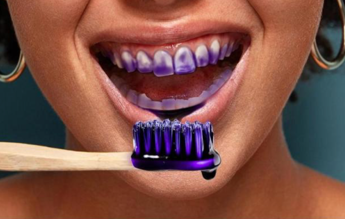 SmileKit Violet 👉 El truco del color para equilibrar tonos amarillos
